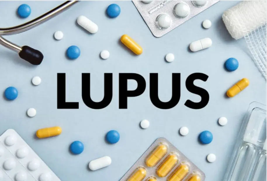 Lupus autoinmune